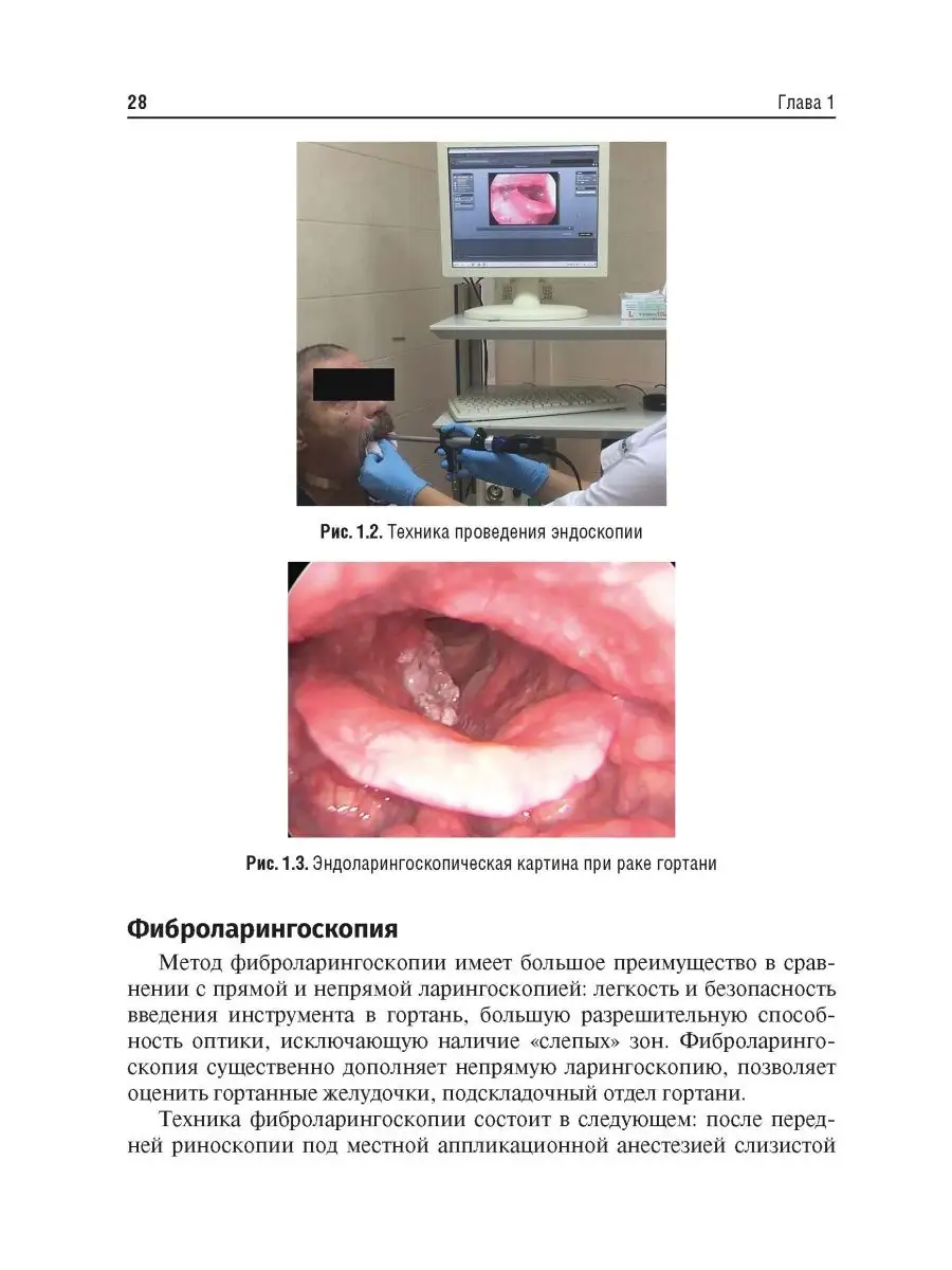 Онкологическая патология в практике врача-оториноларинголога ГЭОТАР  160348775 купить в интернет-магазине Wildberries