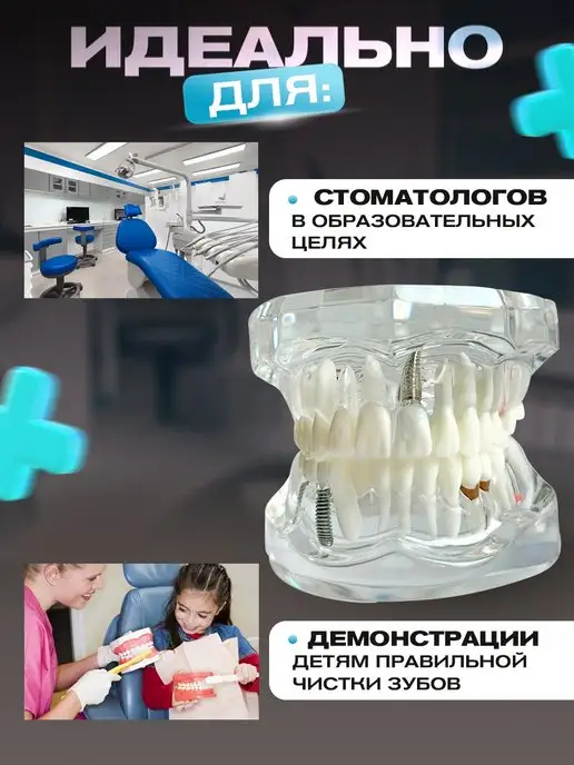 Tooth for tooth Анатомическая модель зубов макет челюсти стоматолог подарок, вариант, фото 4