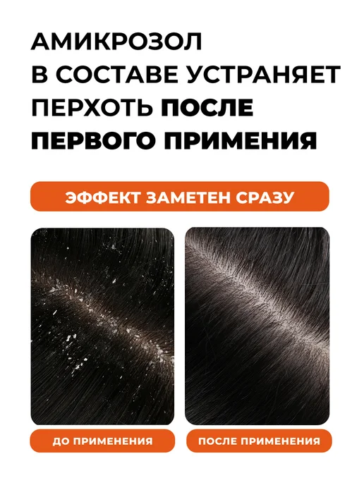 Лошадиная Сила Шампунь от перхоти лечебный с амикрозолом 250мл, 250 мл, фото 2