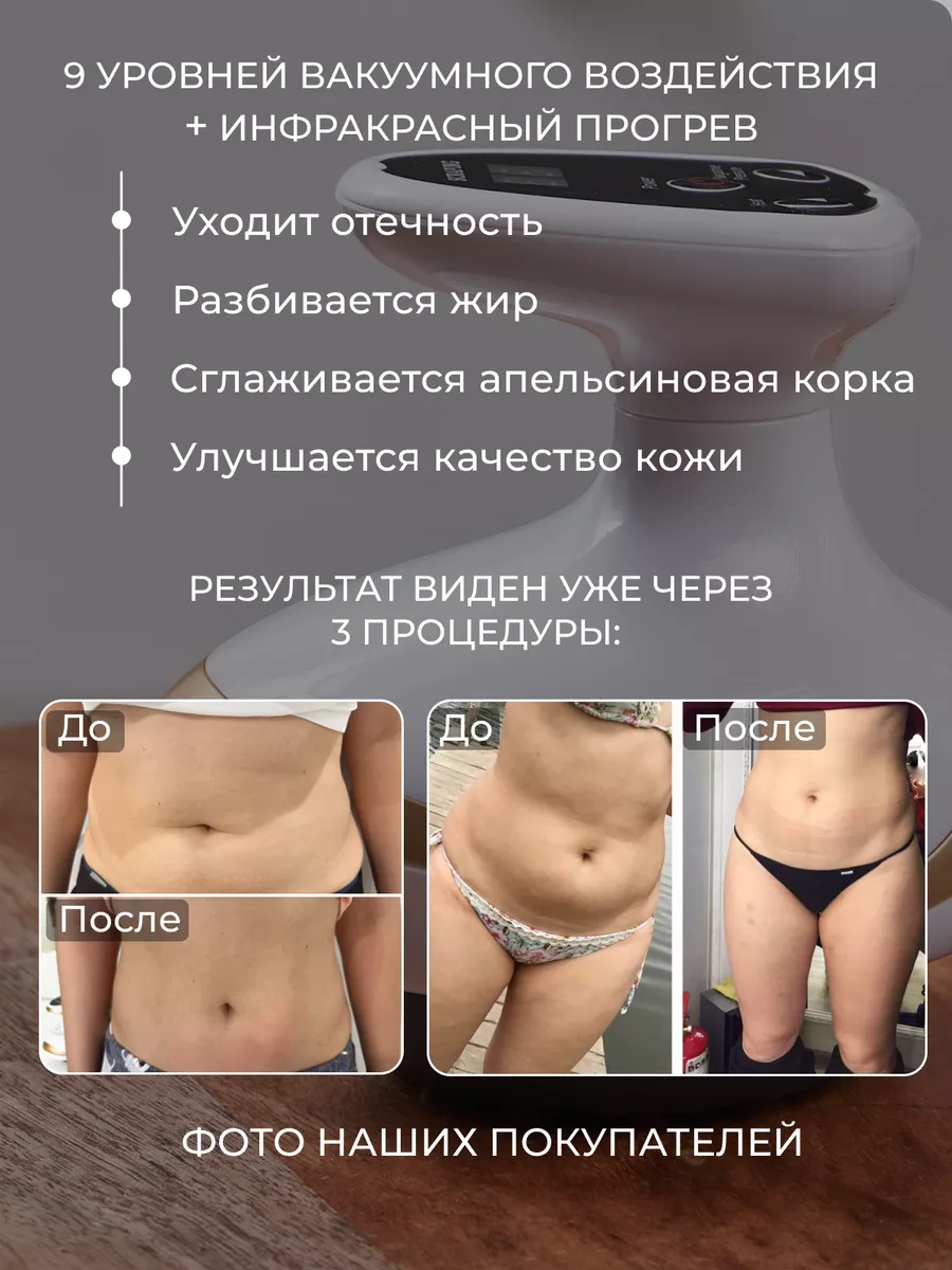 Вакуумный антицеллюлитный массажер для тела ног и ягодиц SkinSolutions  162060126 купить за 2 337 ₽ в интернет-магазине Wildberries