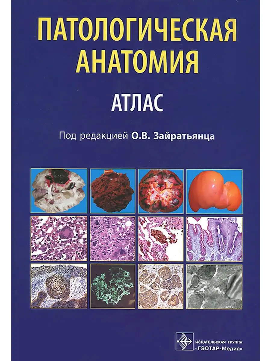 Гематологический атлас фото. Морфологическая диагностика. Луговская атласы. Луговская почтарь гематологический атлас. Луговская атласы.