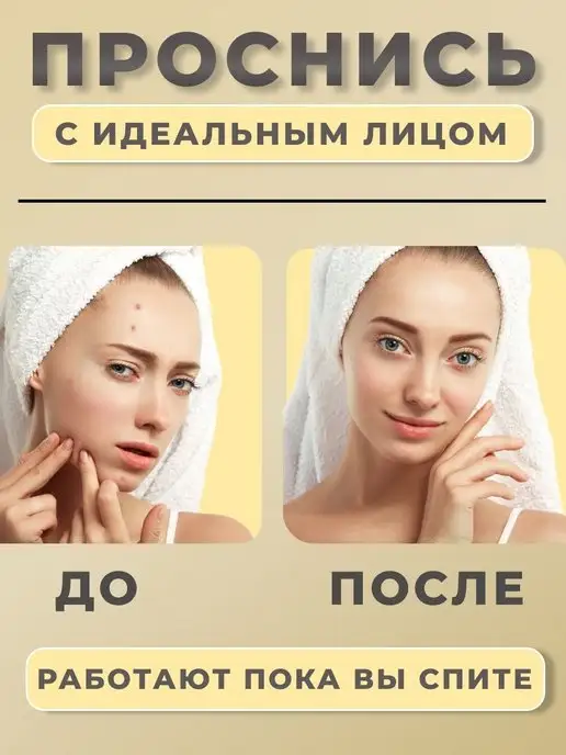 Патчи от прыщей Пластырь от прыщей патчи для лица от акне, вариант, фото 2