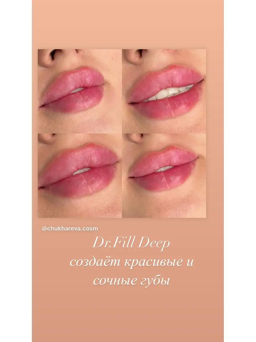 Dr.Fill Deep филлер для увеличения губ DR.FILL 164266948 купить за 2 830 ₽  в интернет-магазине Wildberries