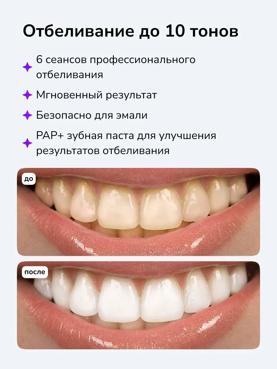 Как отбелить зубы в домашних условиях | EVA Blog