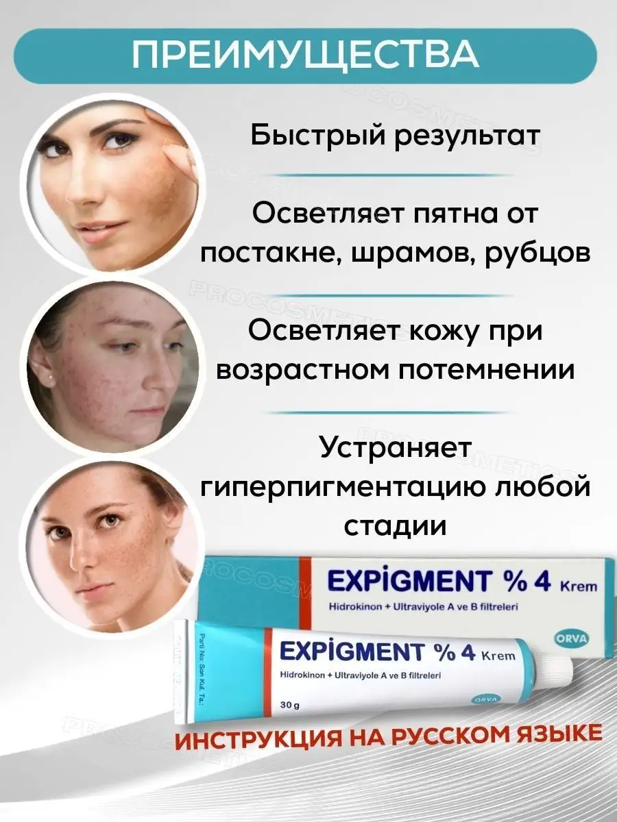 Экспигмент отбеливающий крем для лица Expigment 4% Expigment Turkey  164977254 купить в интернет-магазине Wildberries