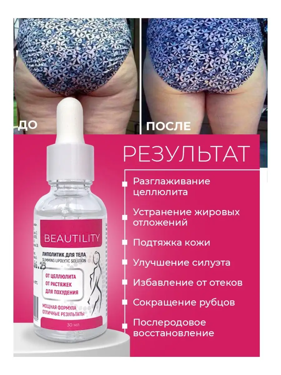 Липолитик для тела жиросжигатель Beautility 165513938 купить в  интернет-магазине Wildberries